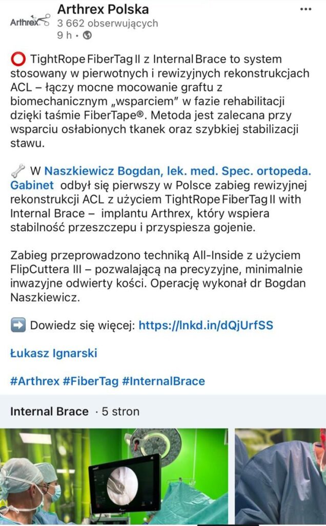 Rekonstrukcja ACL